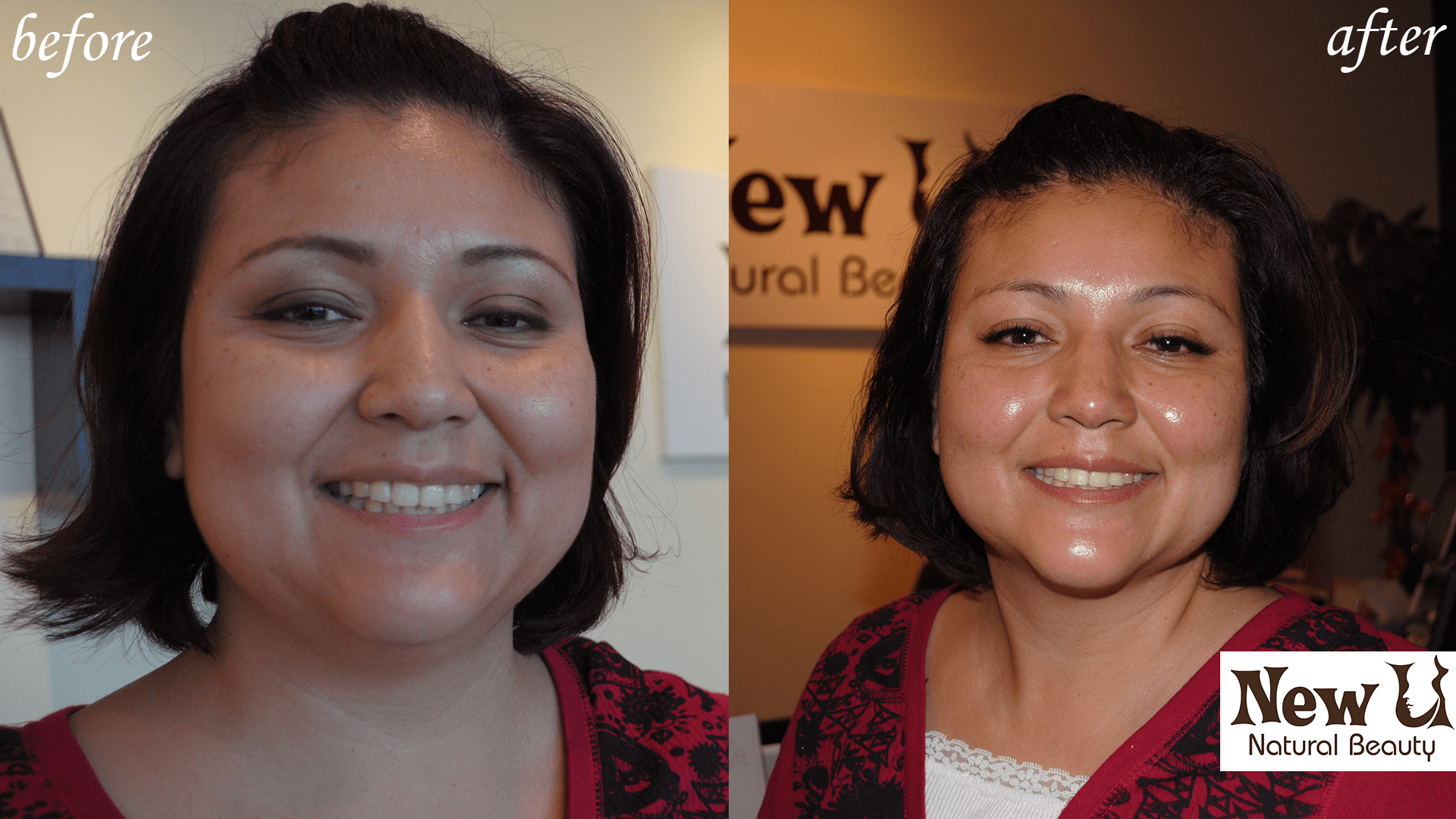 Organic Skin Care 3 Las Vegas Before and After
